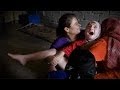 End female genital mutilation: join the Guardians.