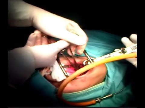 Teh hitam dan potensi Obat tradisional yang baik untuk impotensi untuk pria