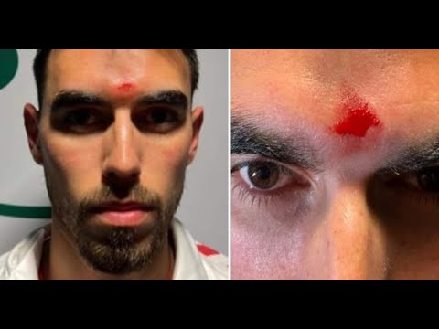 Ricardo Horta atingido com uma garrafa após jogo (Sporting 1-2 Braga)