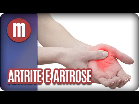 Saúde: artrite e artrose - Mulheres (17/02/17)