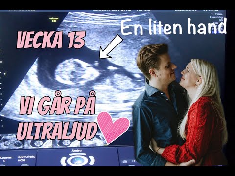 VI GÅR PÅ ULTRALJUD | Gravid vecka för vecka 13