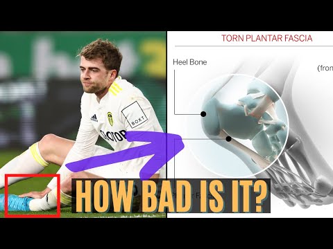 Expert Explains Patrick Bamford Injury (Plantar Fascia Rupture) & Timeline