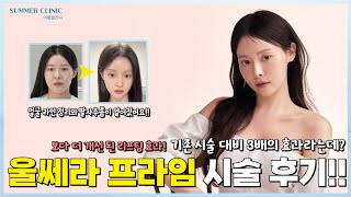 보다 더 개선된 리프팅 효과 | 울타늄 리프팅 브이로그