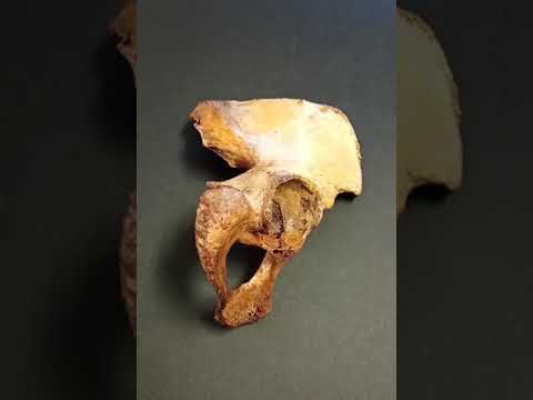 Anatomía real del hueso coxal