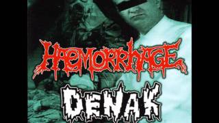 Haemorrhage - Cirrhoetic Liver Distillation