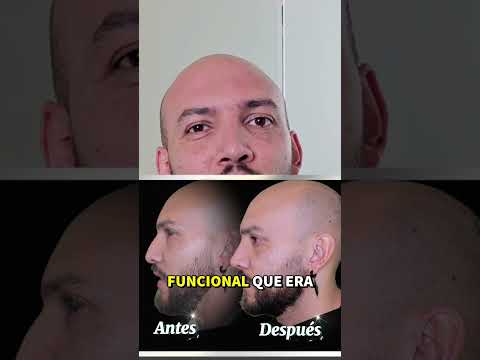 José Christian Ávila Romero-35