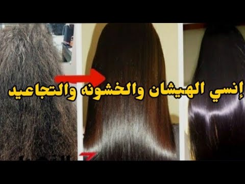 ازاي عالجت شعري ️ وشعر بنتي من الهيشان والخشونه وتطويل ماشاء الله