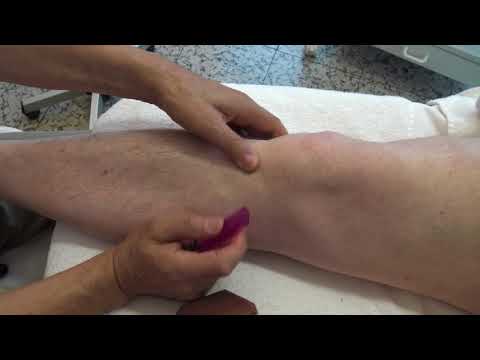 Kurbehandlung mit Gelenken in der Region Orenburg Nach der Schwangerschaft wunder Hüfte