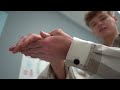 I BROKE MY HAND