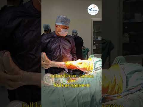 Recovery after Total knee replacement