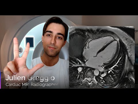 Cardiac MRI at 3.0 Tesla - Tips & Tricks