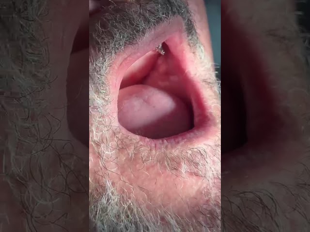 Vídeo