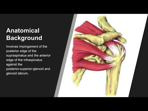 Internal Impingement