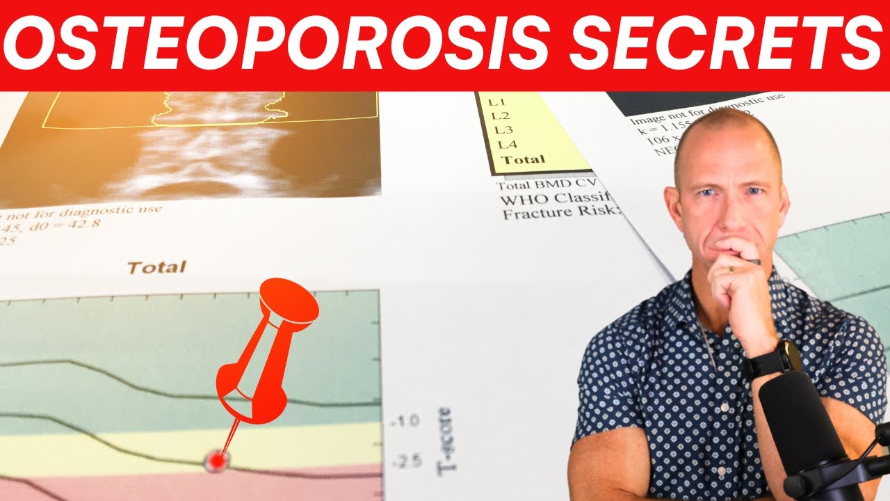 What They Don't Want You To Know about Osteoporosis!