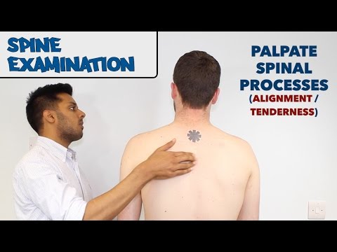Spine Examination - OSCE Guide (old version) | UKMLA | CPSA