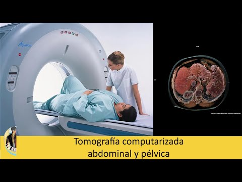 Abdominal and pelvic computed tomography