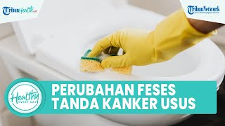 Waspadai Perubahan Feses Bisa Jadi Tanda Kanker Usus, Begini Penjelasannya