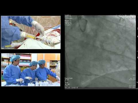 TCTAP 2015 CTO Live Case Session II