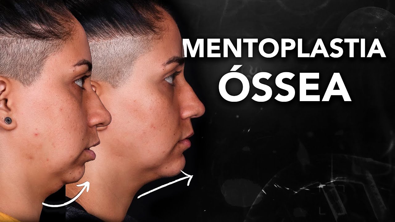 João Pedro Paulino Mazzon-83