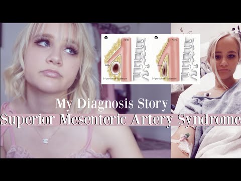my rare diagnosis story: superior mesenteric artery syndrome