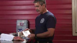 First Aid Tips : How to Treat Second &amp; Third-Degree Burns