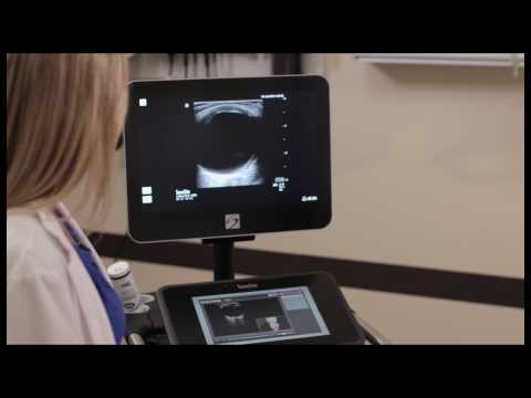 How To: Scan-Along Visual Guides on the Sonosite X-Porte 3D Video