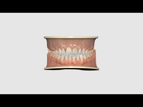 OrthoSimulation