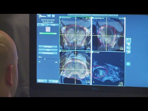 New study changing treatment for men with prostate cancer