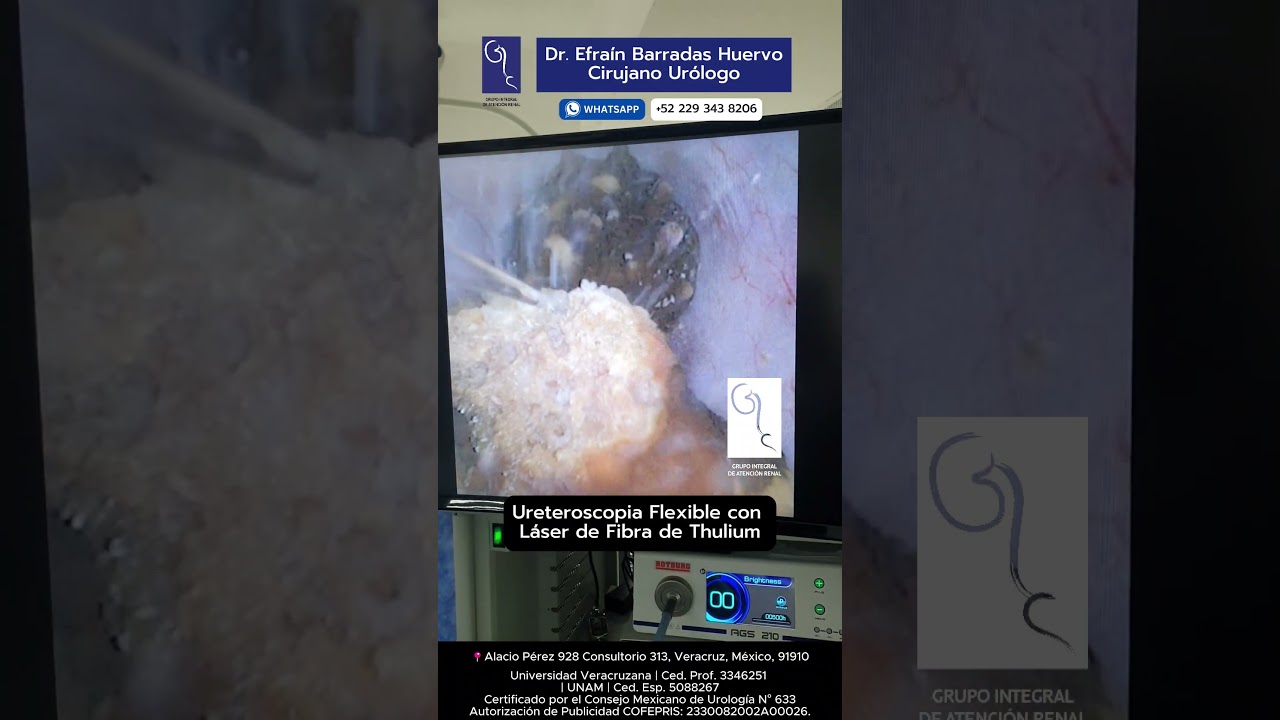 Efrain Barradas Huervo-41