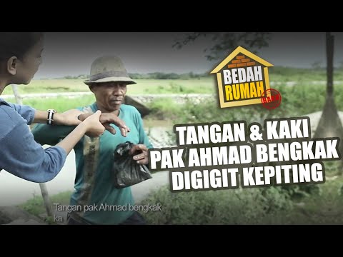 BEDAH RUMAH EPISODE 34 - Tangan dan Kaki Pak Ahmad Bengkak digigit Kepiting
