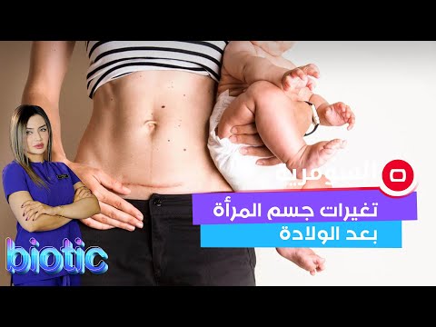 شاهد بالفيديو.. تغيرات جسم المرأة بعد الولادة