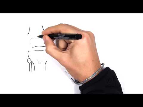 Clinical Anatomy   Knee