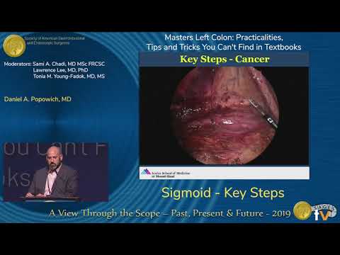 Sigmoid - Key Steps