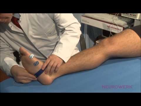 Motoric Neurography - Tibial Nerve