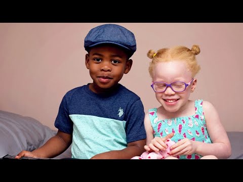 Mom's Twins Have 2 Different Skin Colors