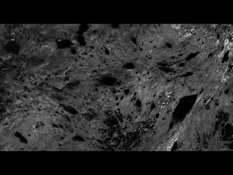 Alpenglow rapid imaging of rapid samples of fresh human tissue