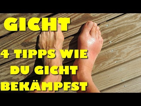Traditionelle Medizin Osteoarthritis des Knies Sehr wund Ellenbogengelenk