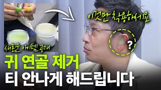 2026 코성형 신상템 최초공개✨귀 모양을 그대로 유지해주는 아이템 등장!