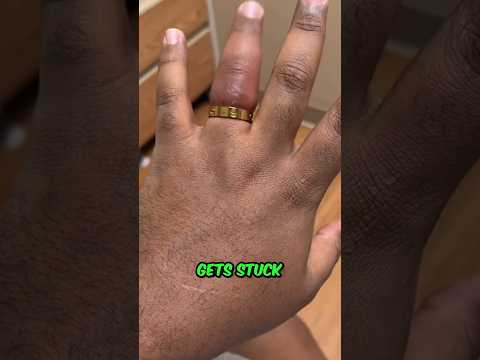How To Remove STUCK Ring 😱