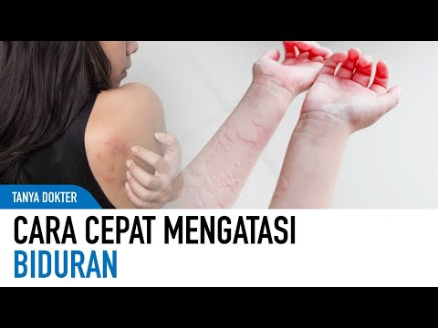 Quick Way to Treat Hives at Home From a Dermatologist | Kata Dokter