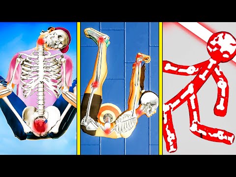 I spent 3 years playing the best bone breaking games so you don’t have to