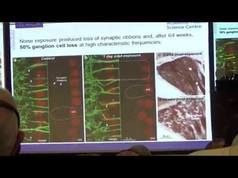 Trauma acustico "seconda parte"