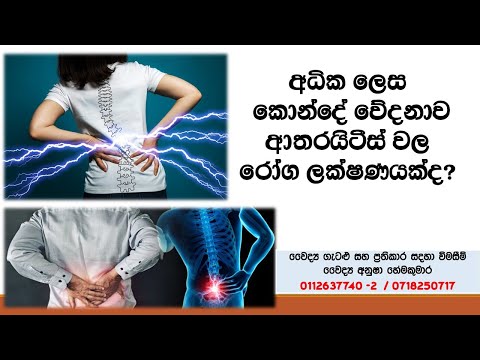 අධික ලෙස කොන්දේ වේදනාව ආතරයිටීස් වල රෝග ලක්ෂණයක්ද? -Dr.Anusha Hemakumara -2021.03.25- SiyathaTV