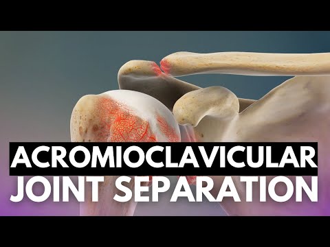 Effects of Cannabis on your body