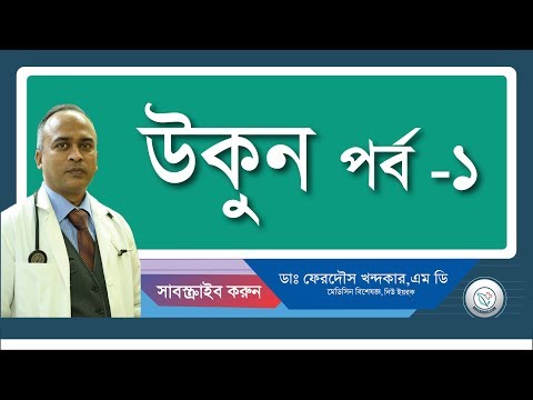 উকুন-১(সাধারন ধারনা)