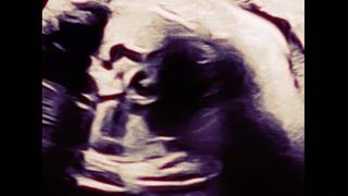 Lirik Lagu Goodnight - Adikara: Let All The Dreams Starts To Cloud Your Night