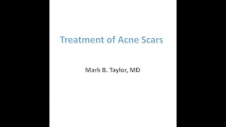 Acne Scar Treatment – Laser & Subcision of Pitted, Boxcar, Keloid, Hypertrophic Acne Scars