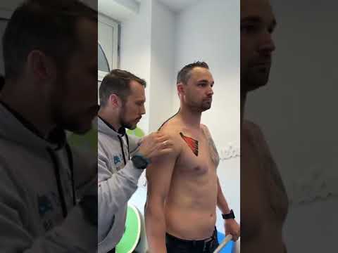 Anatomieshortcut #1 Schulter