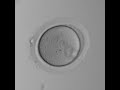 Time_lapse video: embryo  splitting occurs on day 4 into twins