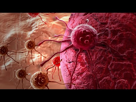 Myeloma Awareness Month Declared By Health Minister - March 17, 2022 - Micah Quinn